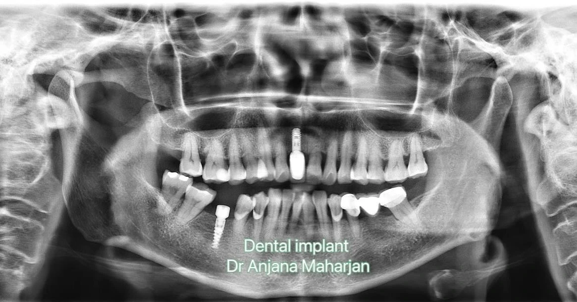 My Dental Clinic - My Dental Clinic